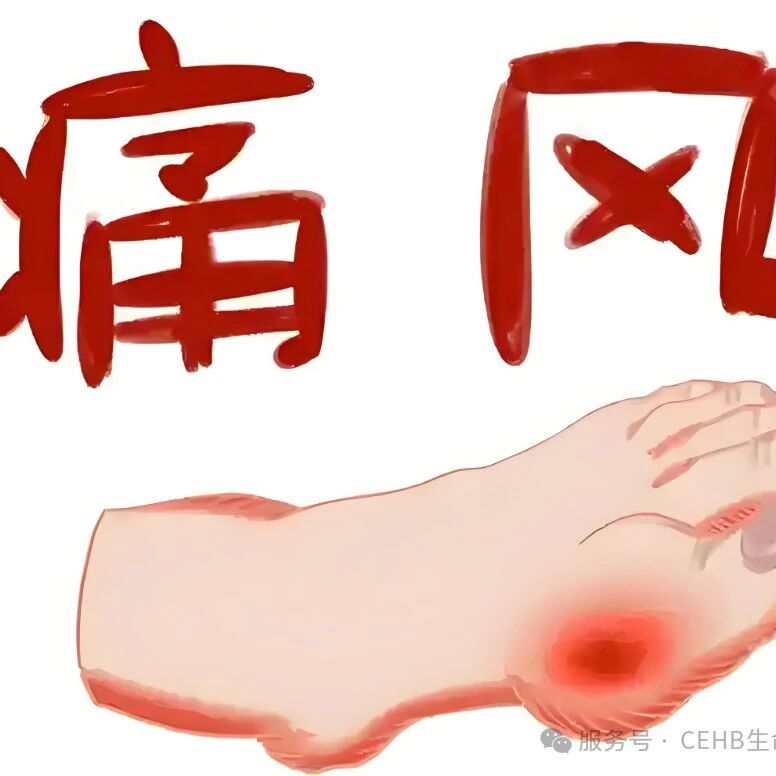 到底痛风离你还有多远